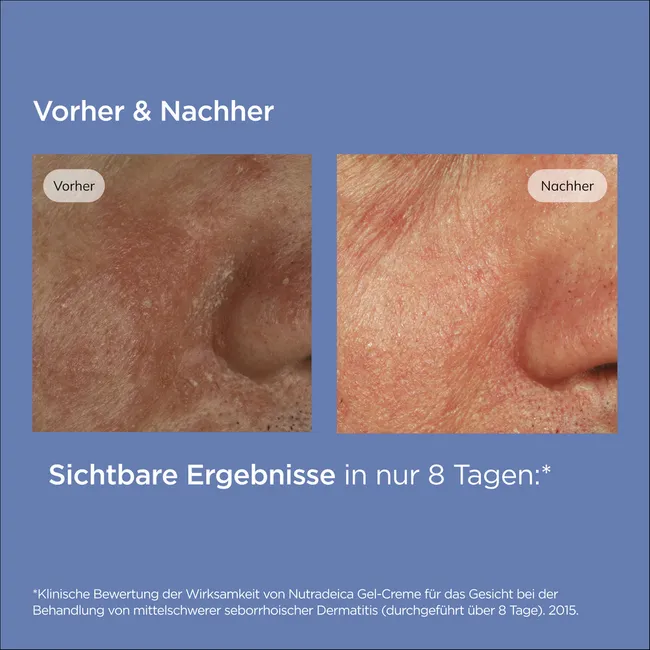 Nutradeica® Gel-Creme